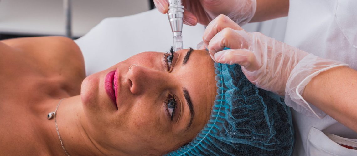Side view of an adult woman with medical disposable cap receiving mesotherapy treatment with dermapen on face by anonymous cosmetologist in the spa center.